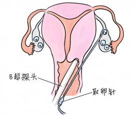 幼儿学画画，佛山捐卵宝宝学画画，学画画的好处，如何学画画