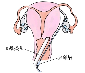 幼儿学画画，佛山捐卵宝宝学画画，学画画的好处，如何学画画
